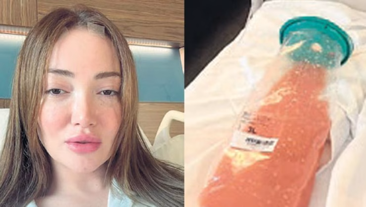 Dolgu maddesi şok etti