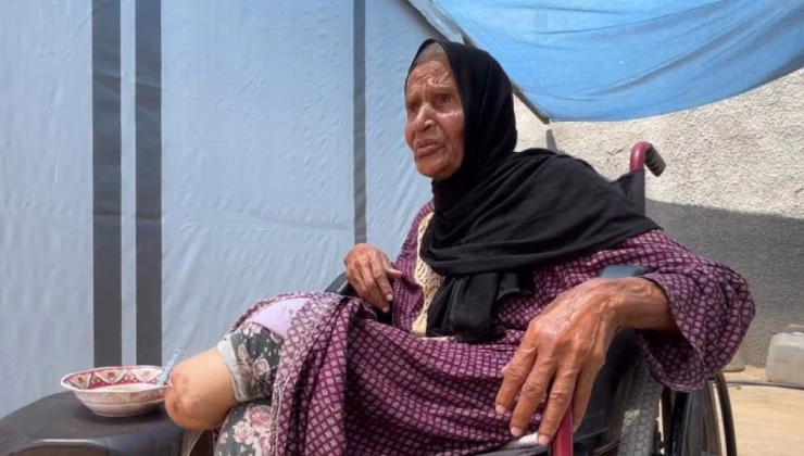 Nekbe’yi yaşamıştı 2025’te de ayağını kaybetti!