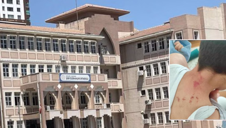 Şanlıurfa haberleri: Öğrenciye feci darp! Öğretmen tutuklandı | SON DAKİKA HABERİ | Son dakika haberleri