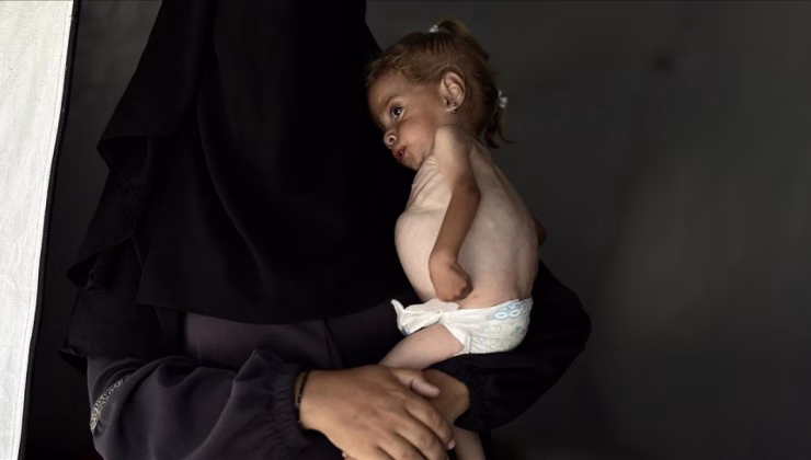 Gazzeli minik kız, ölümle pençeleşiyor