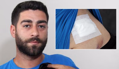 Karnında ağrı hissetti! Baktığında kan gördü! Gerçek röntgende belli oldu! | Son dakika haberleri