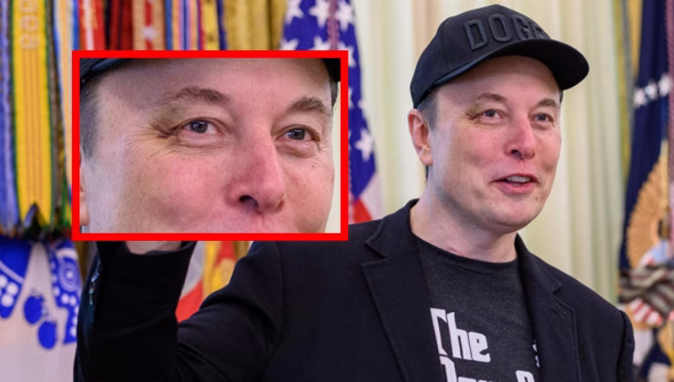 Sağ gözü neden mor? Elon Musk sebebini açıkladı