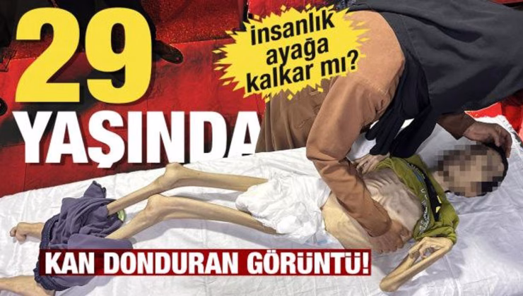 İsrail, açlık silahına sarıldı! Genç, yaşlı dinlemeden katlediyor!