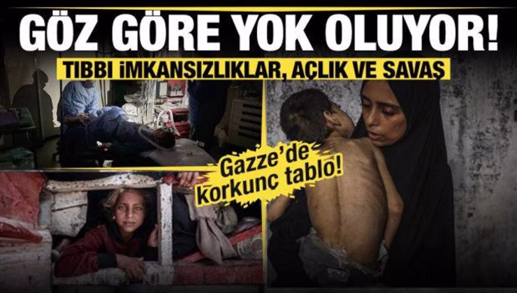 Tıbbı imkansızlıklar, açlık ve savaş… Gazze göz göre göre yok oluyor!