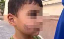 Evde uyuyan çocuğu lağım faresi ısırdı!