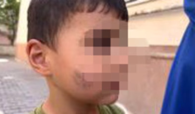 Evde uyuyan çocuğu lağım faresi ısırdı!