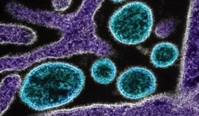 Gana’da M çiçeği alarmı! Virüs yayılmaya devam ediyor!