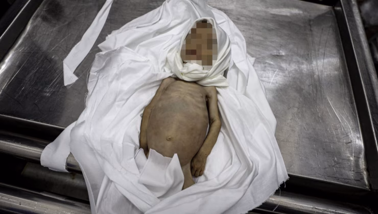 Gazze’de açlık nedeniyle ölenlerin sayısı 212’ye yükseldi