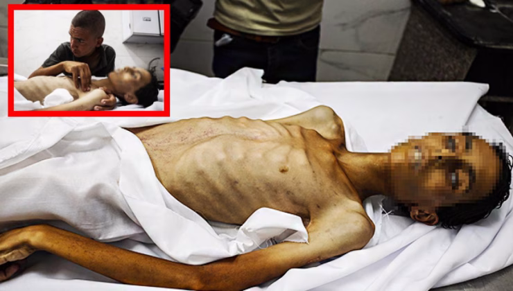 Gazze’de açlıktan şehit olanların sayısı 175’e çıktı