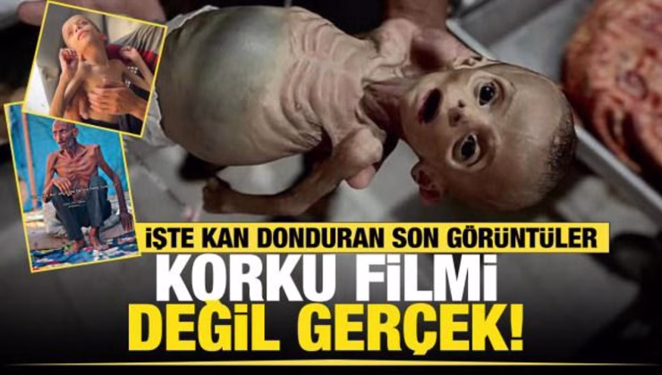 İnsanlık Gazze’de sınıfta kaldı! Açlıktan ölenlerin yarısından fazlası çocuk!