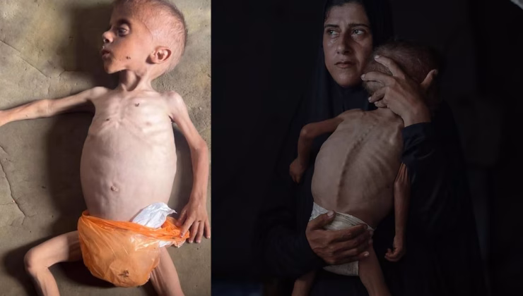 İsrail’in açlık silahı… Gazze’de 40 binden fazla bebek ölüm riskiyle karşı karşıya