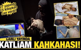 Katliam kahkahası! İsrail Gazze’de kıtlığı dayatıyor! 27 yaşında 15 kiloyken can verdi!