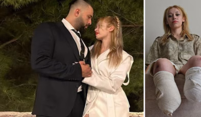 Evlilik yıl dönümünde kâbusu yaşadı! İki bacağını kaybetti…